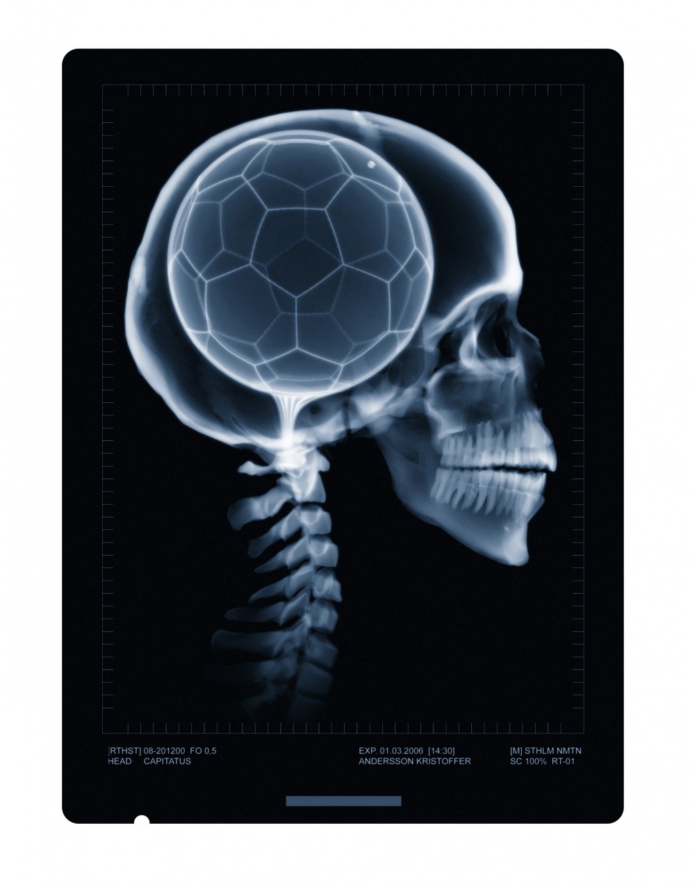 footballxray