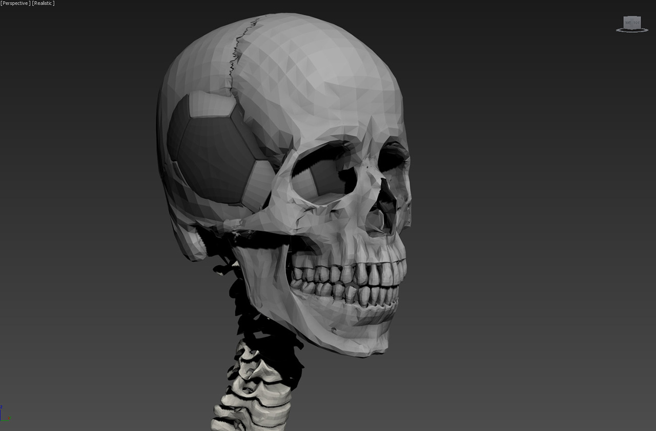 footballxray