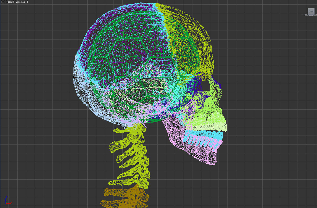 footballxray