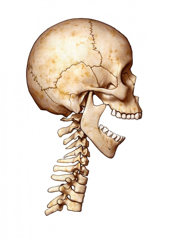 headache